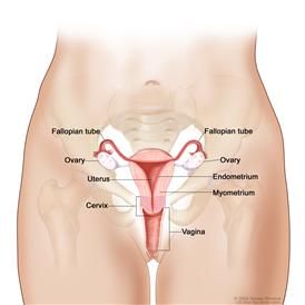 Ovarian-Cancer