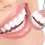 Myths and Truths About Teeth Whitening