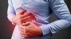 Things You Should Consider Before Bariatric Surgery
